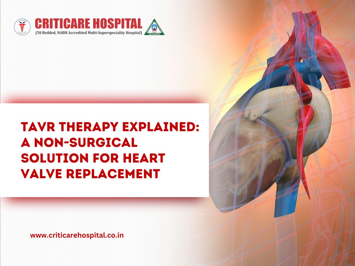 TAVR Therapy Explained