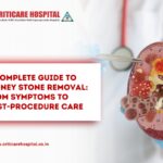 Guide to Kidney Stone